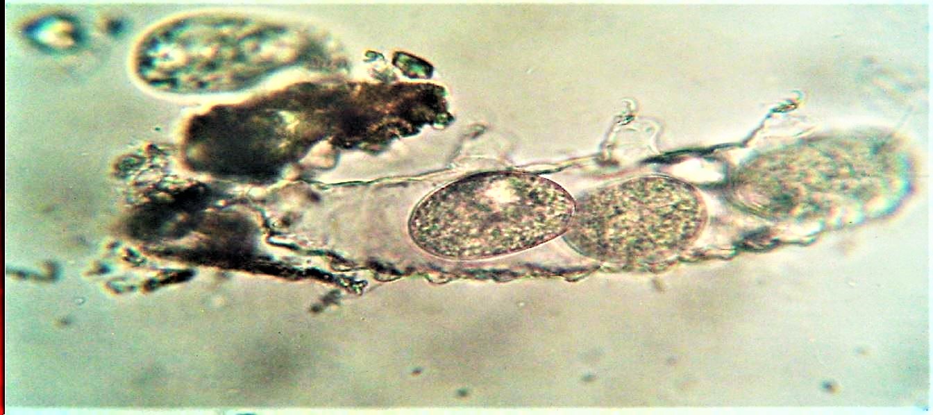 tardigrad(morto ??) con strana infestazione. idee?